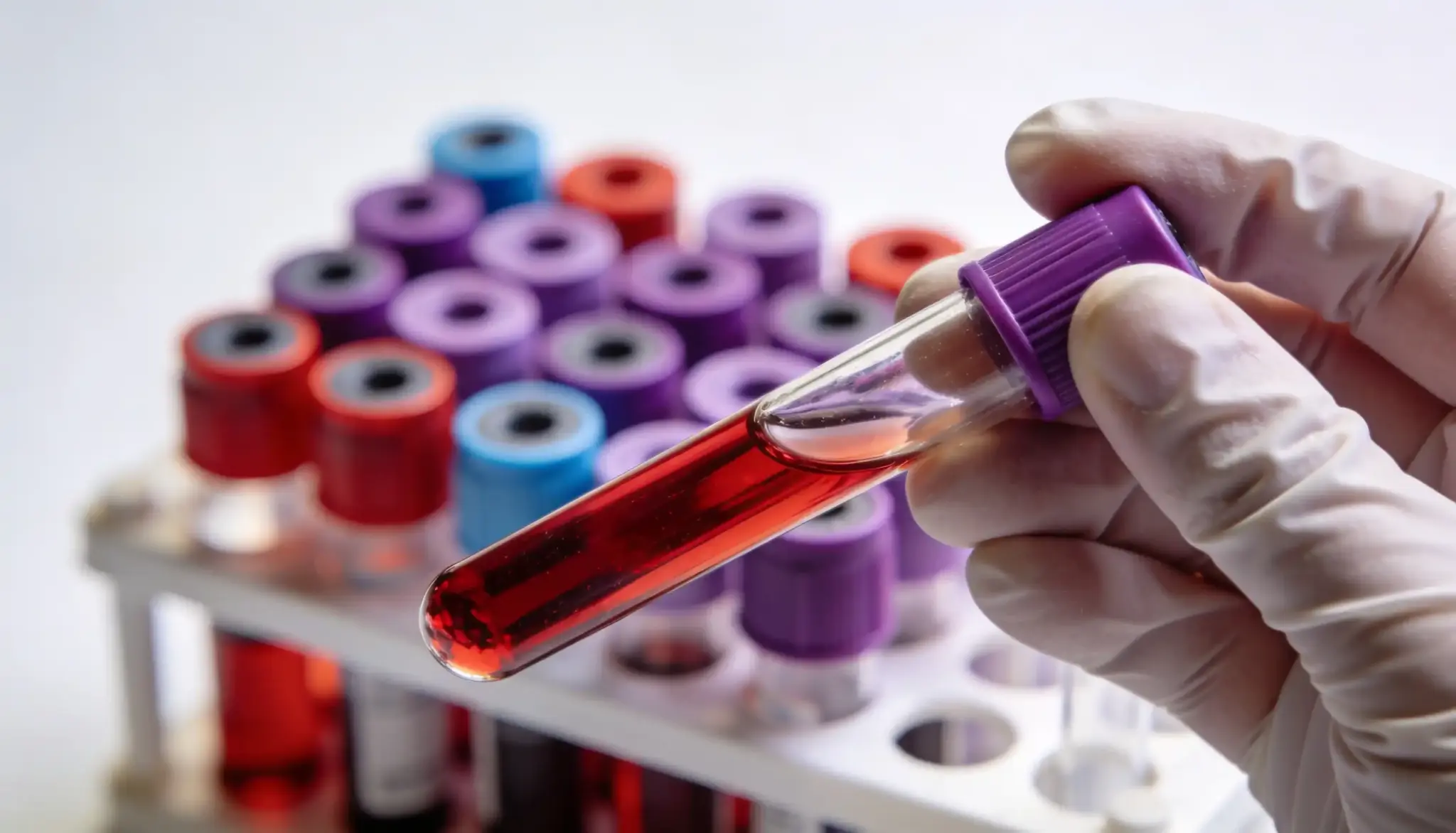 how-long-std-tests-take